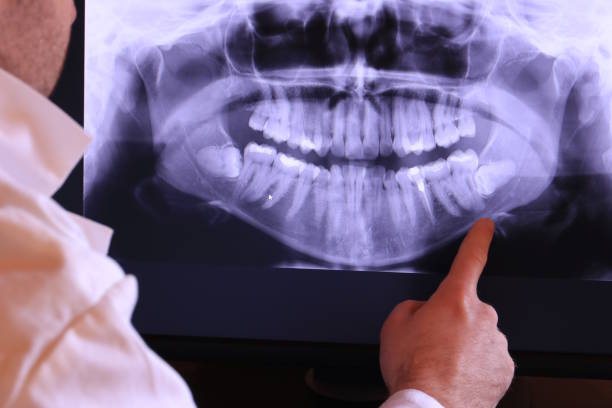 Best Holiday Emergency Dentist in Crestwood, MO